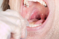 2013 11 25 12 43 56 283 Oral Pharynx Exam 200