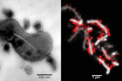 Left image shows the tight physical association between TM7x cells and XH001. Right image shows TM7x cells (red) attached to the surface of XH001 (white). Images courtesy of UCLA.
