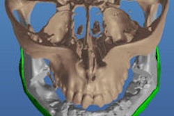 2015 01 08 16 45 35 262 2015 01 09 Syrian Implant Thumb