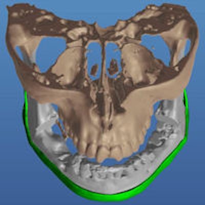 2015 01 08 16 45 35 262 2015 01 09 Syrian Implant Thumb