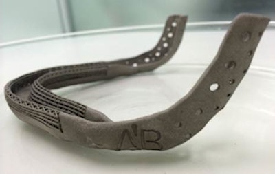 The final 3D-printed, custom-made, titanium jaw.