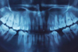 2015 03 25 14 35 02 39 Panoramic Xray 200