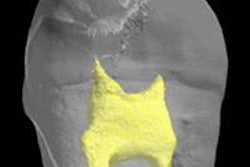 2015 04 30 16 12 32 255 2015 05 01 Stem Cells Repair 200 20150430231435