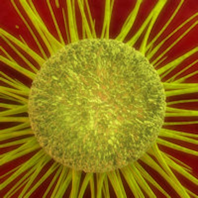 2015 05 04 15 32 03 483 Cancer Cell Yellow 200
