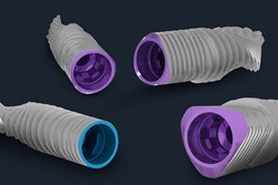2015 06 04 13 23 00 663 Mis Implants V3