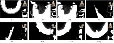 2015 08 20 09 57 13 336 2015 08 27 3 D Landmarking 800