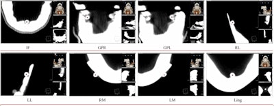 2015 08 20 09 57 13 395 2015 08 27 3 D Landmarking 400