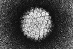 2014 08 25 16 33 23 1 Hpv Virus Nih 200