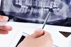 2015 08 20 09 57 13 450 Panoramic Dental Xray 200