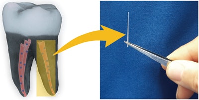 A 3D image of a tooth filled with nanodiamond-enhanced gutta-percha and an individual gutta-percha point. Image courtesy of American Chemical Society/Dong-Keun Lee.