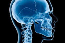 2015 11 18 16 50 12 617 Head Neck Xray 200