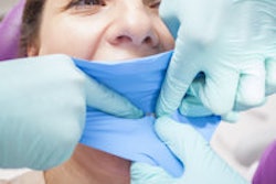 2015 12 14 16 29 06 772 Dental Dam 200