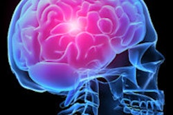2016 01 19 15 11 36 702 Brain Headache 200