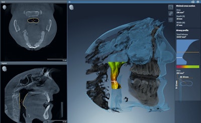 2016 02 29 12 35 19 32 Chicago Weekend Sirona Sicatair 400