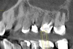 2016 03 15 14 57 56 831 2016 03 16 Cbct Fig8 Thumb