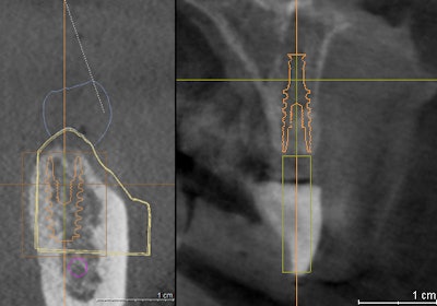 2016 03 15 14 57 59 944 2016 03 16 Cbct Fig1
