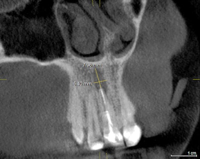 2016 04 04 13 20 41 642 2016 04 05 Ramirez7