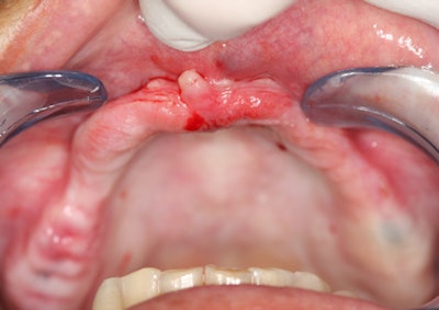 2016 04 04 13 20 45 993 2016 04 05 Ramirez1