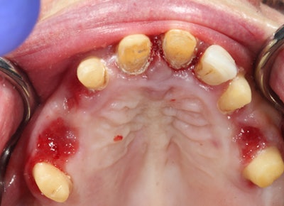 2016 04 20 11 19 05 467 2016 04 28 Implantology8