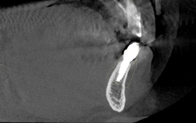 Figure 4: What a difference a guide makes.