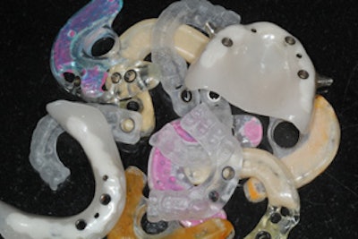 Figure 1 (above): A potpourri of surgical guides used. Figure 2 (below): A well-positioned guided implant. All images courtesy of Dr. Anthony Ramirez.