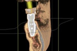 2016 04 20 12 06 13 529 2016 04 28 Implantology Thumb