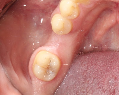 2016 05 18 17 55 52 735 2016 05 26 Ramirez15