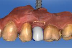 2016 05 18 17 55 53 523 2016 05 26 Ramirez11 20160519005837