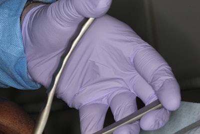 Figure 2: The Physics Forceps instrument handles are never squeezed but held lightly in your hands, so the instrument is really a lingual elevator rather than a forcep. The handles should be held very lightly, allowing the instrument to do the work. No strength or arm pressure is required. Little pressure is placed on the bumper or fulcrum point.