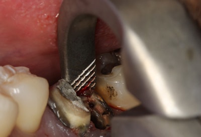 2016 06 01 10 51 37 958 2016 06 02 Kosinski2 Image3