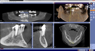 Galileos scan that influenced referral.