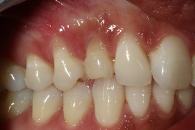 2016 06 13 15 03 12 258 2016 06 23 Ramirez5 Image1