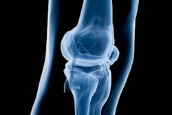 2016 07 07 15 06 00 187 X Ray Knee 400