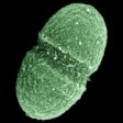 2016 08 25 16 27 40 174 Enterococcus Faecalis Bacteria 400