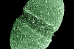 2016 08 25 16 27 40 174 Enterococcus Faecalis Bacteria 400