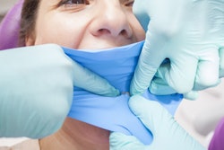 2016 09 28 15 13 44 142 Dental Dam 400