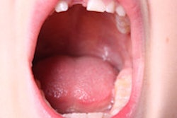 2015 01 30 12 24 24 385 Kid Open Mouth 200