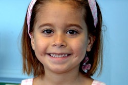 2016 08 29 16 27 58 832 Girl Smiling 400