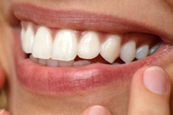 2017 01 19 15 06 01 540 Smile2 400