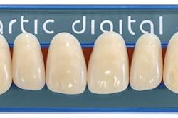 2017 02 07 12 29 12 205 Heraus Kulzer Artic Denture 20170207192931