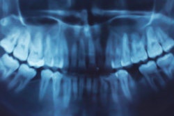 2017 02 16 11 02 17 636 X Ray Panoramic Dental 400