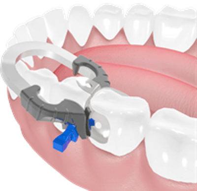 The iMatrix system. Image courtesy of Pac-Dent.
