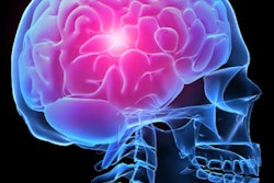 2017 02 21 16 00 08 230 Brain Headache 400