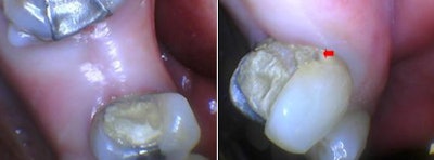 Figures 2 and 3: Clinical photographs show the patient's preoperative condition.