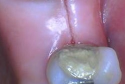 2017 02 23 12 52 51 839 Figure4 Initial Incision Thumb