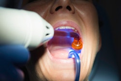 2017 03 05 14 29 24 914 Curing Light 400