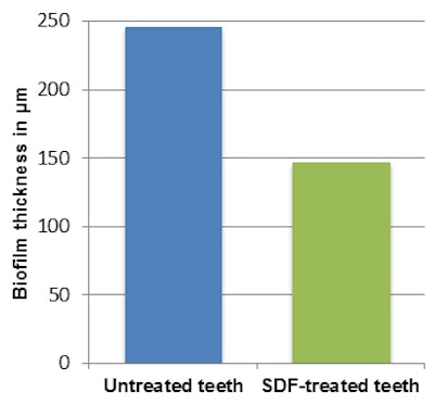 2017 03 23 14 44 40 862 2017 03 24 Sdf Chart
