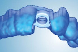 2017 03 24 10 38 09 398 Planmeca Romexis Implant Guide 300