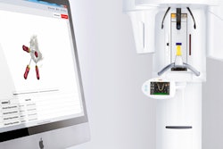 2017 03 27 13 27 35 145 Dentsply Sirona Endo Software 20170327202815