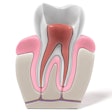 2017 01 25 17 32 55 822 Endodontics Root Canal 400